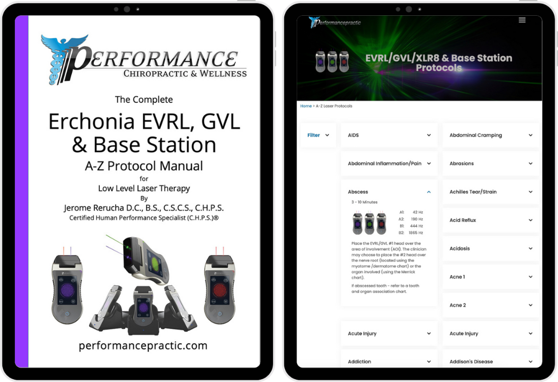 ECHO CONRROL トライアル エコー コントロール コントロールレバー